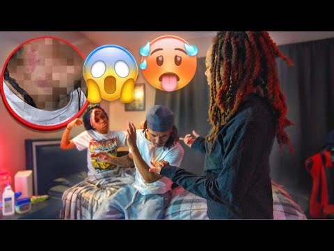 HICKEY PRANK ON GIRLFRIEND😱 *She Went Crazy* Ft. @sgcbrooke