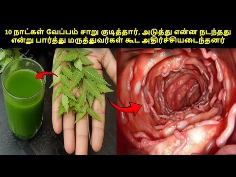 10 நாட்கள் வேப்பம் சாறு குடித்தார், அடுத்து என்ன நடந்தது என்று பார்த்து மருத்துவர்கள் கூட அதிர்ச்சி!