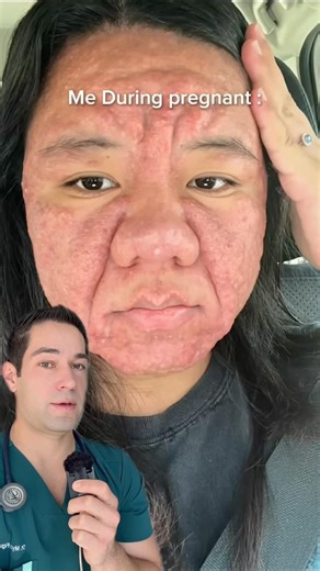 How pregnancy affects your looks