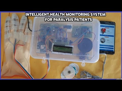 SmartCare IoT Intelligent Health Monitoring System for Paralysis Patients