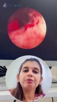 Hysteroscopy Explained: Diagnosis & Treatment #Hysteroscopy #womenshealth