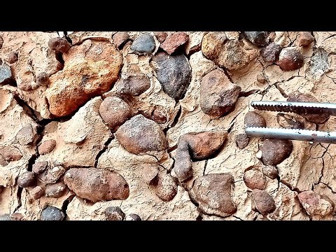 Satisfying Pimple Popping! 😱 | Huge Blackheads Removed