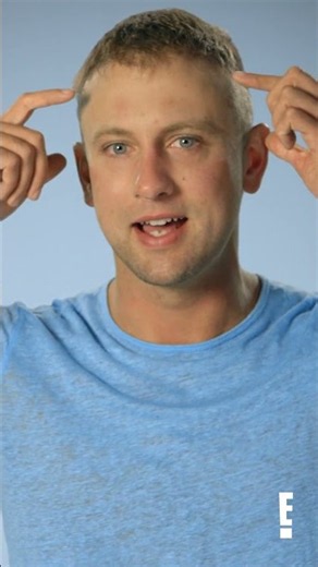 Mike has a MASSIVE scar after a hair transplant gone wrong?! #botched