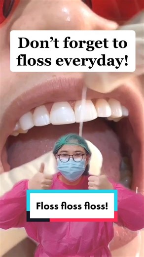 Flossing with Veneers: A Comprehensive Guide