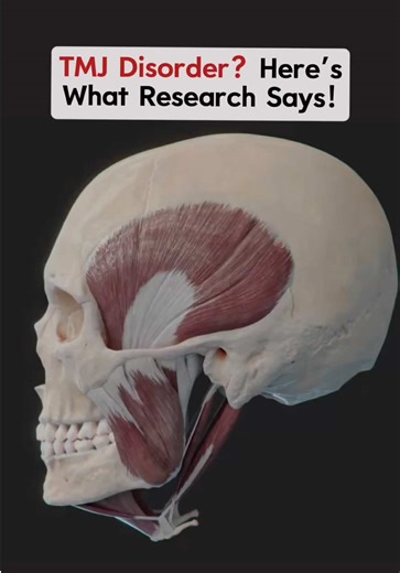 Here’s what the Research says on expensive bite correction to fix TMJ pain… The reality is, TMJ problems can often be rehabilitated with conservative care – just like any other joint. Studies show bite issues (malocclusions) have only a modest, inconsistent link to TMJ disorders . Even if you have an overbite or crossbite, your risk is only slightly higher – and most people with those traits never develop TMD. Large studies show your bite explains 5% or less of who develops TMD . Jaw pain is usu