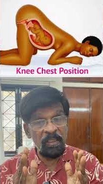 Breech Baby-யின் Head திரும்புமா? எத்தனை வாரம் வரை Chance இருக்கு? | Dr. Rajasekar