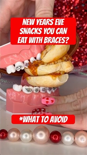 NEW YEARS EVE SNACKS YOU CAN EAT WITH BRACES? *what to avoid 🧐 #braces #newyear2026 #foodasmr