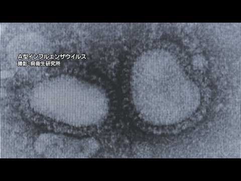 インフルエンザの感染拡大続く 前の週から1.5倍以上に増加 村山保健所管内では注意報レベル超える