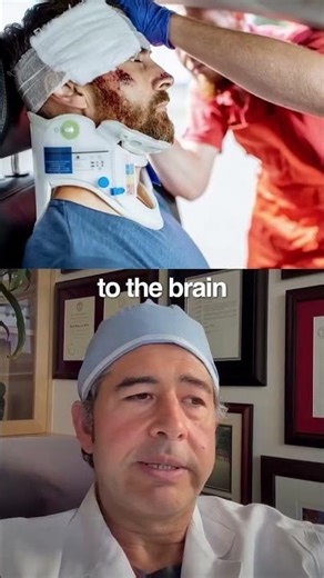 Not all head injuries are the same 👇