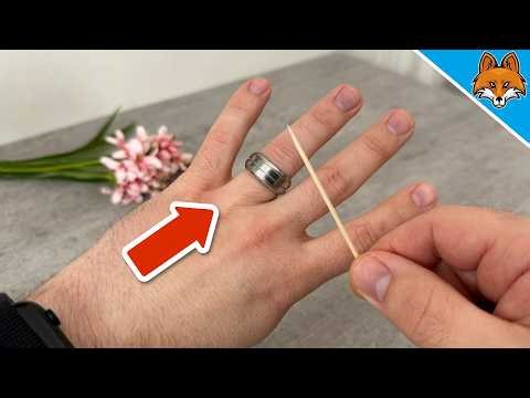 A Doctor showed me how to Remove the Ring that was stuck on my Finger💥(Amazing)🤯