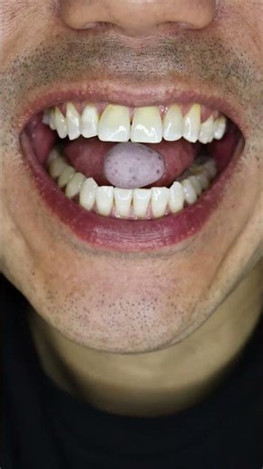 ASMR | Satisfying Chocolate Bite 🍫 #DoctorTristanPeh #ASMR