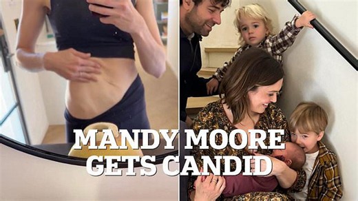 Mandy Moore gets candid about her 'loose skin'
