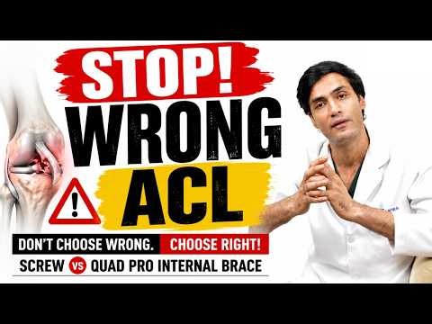 Stop Choosing the Wrong ACL Surgery! Screw vs Quad Pro Internal Brace Explained