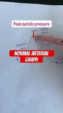 Normal Arterial graph/ Arterial Wave #icu #icutips #arterialwaveform #arterialgraph #ibp