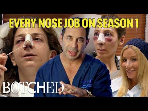EVERY Nose Job on Season 1: Life Saving Reconstructions, Tears and More (Compilation) | Botched | E!