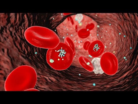 Fears microplastics found in environment could trigger heart disease