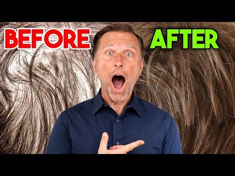 The Truth About Your Hair: How to Get Thick, Shiny Hair Fast (Root Cause Solution) Dr. Eric Berg DC