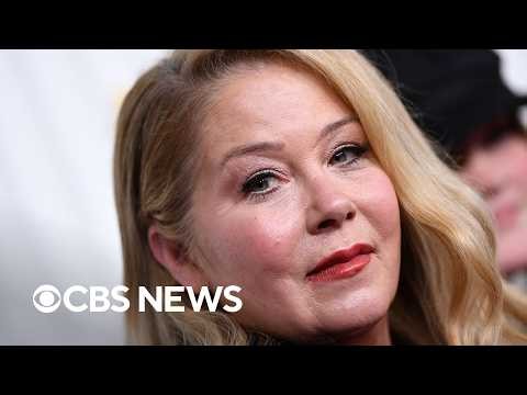 Doctor explains how a misdiagnosis of multiple sclerosis happens amid Christina Applegate news