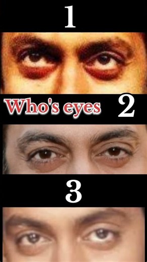 Whose Eyes Are These? 👀🔥 | 1/100 People Challenge #shorts