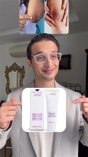 Stop Hiding Dark Knees & Elbows — Do This Instead || Dr. Sarin ||