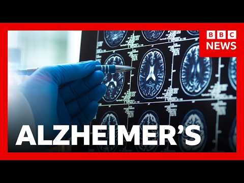 'Breakthrough' Alzheimer's drugs unlikely to benefit patients, report suggests | BBC News
