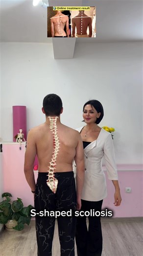 S-shaped scoliosis requires an individual asymmetric approach. This exercise focuses on postural control, spinal alignment, and stability. ✔️ Controlled movement ✔️ Asymmetric correction ✔️ Individual exercise selection 📍 Armenia | Online & Offline 📩 WhatsApp: 374 98 149914 #scoliosis #sshapedscoliosis #posture #spinehealth #rehabilitation