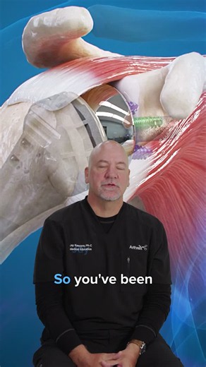 Considering reverse total shoulder replacement surgery? Learn what to expect. Explore this animation to better understand the procedure, from shoulder anatomy and implant placement to the goals of… | Arthrex