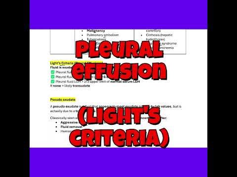 Pleural Effusion - Light's Criteria | Pseudo exudate | High Yield Question