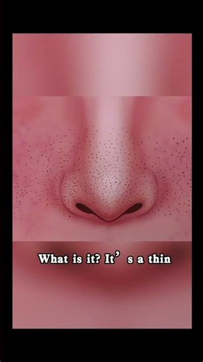 How to Remove Blackheads Gently? Try This Skincare Nose Patch!#skincare #beauty #blackheads