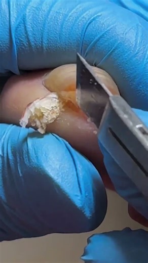 Satisfying Pedicure Video! #pedicure #toenails