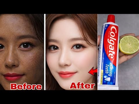 Colgate toothpaste for face whitening | Lemon and Colgate 