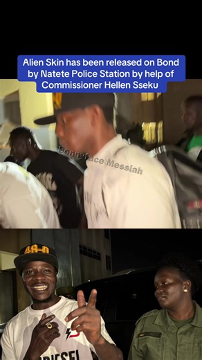 Alien Skin has been released on Bond by Natete Police Station by help of Commissioner Hellen Sseku #bonnyfacemessiah #alienskinug #alienskinarrested