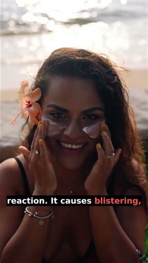 Can You Survive Sun Poisoning and How Long Does It Take? #shorts