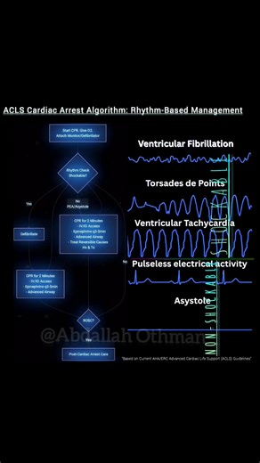 ACLS Cardiac Arrest Algorithm:Shockable vs. Non-Shockable Rhythm Pathway · Shockable: VF/VT. Treat with immediate defibrillation. · Torsades de Pointes is a polymorphic VT. Defibrillate if pulseless. Correct underlying causes (e.g., hypomagnesemia, long QT). · Non-Shockable: PEA/Asystole. Treat with CPR, Epinephrine, and reversible causes (Hs & Ts). Cycle: 2 min CPR → Rhythm Check → Act. #TorsadesDePointes #PolymorphicVT #CardiacArrest #ACLS #ECG #VF #VT #PEA #Asystole #Resuscitation #Cardiology