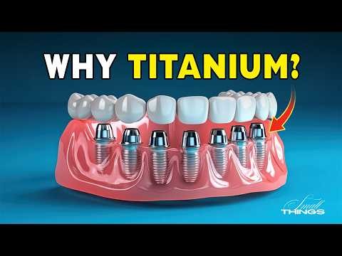 Titanium in Dental Implants | Safe or Not?