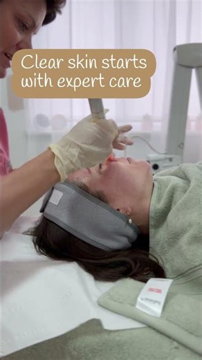 Advanced IPL Technology for Skin Treatment