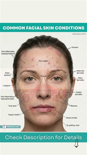 Common Facial Skin Conditions You Should Know | Skin Diseases