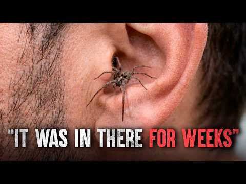 The Scariest Spider Attacks: They Barely Survived