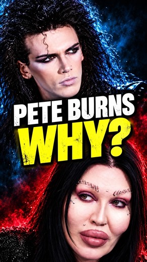 Pete Burns The Surgeon Warned Him… So Why Did He Keep Changing His Face