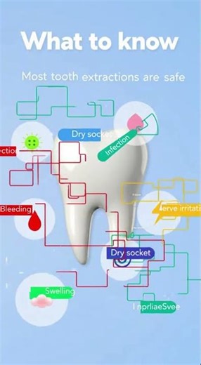 🦷 What Are the Risks of a Tooth Extraction? Here’s the Truth