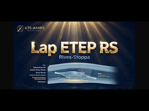 Lap ETEP RS with Voice over | Dr. Pranay Gourav | Advanced Laparoscopic and GI Surgeon