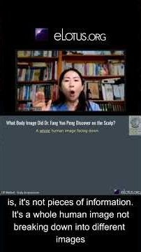 Read Your Body with Fang Scalp Acupuncture!