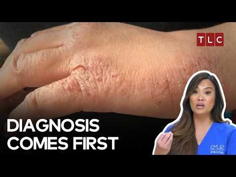 From Strange Bumps To A Treatment Plan | Dr Pimple Popper S4, S3 & S2 | TLC India