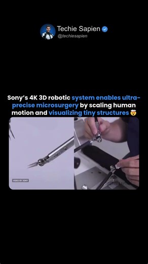 This Is How Sony Is Revolutionizing Surgery with 4K 3D Robots 🤯🧠