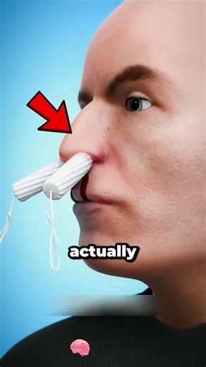 What Happens If You Suddenly Get a Nosebleed!