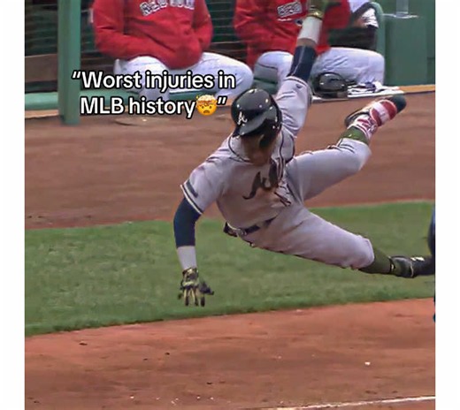 Worst injuries in MLB history
