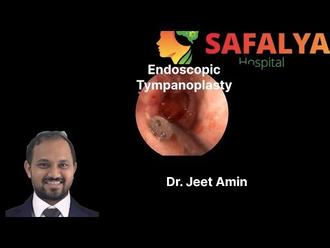 Right Endoscopic Tympanoplasty - Dr. Jeet Amin