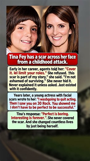 Tina Fey Refused to Hide Her Scar—and Changed Lives #shorts