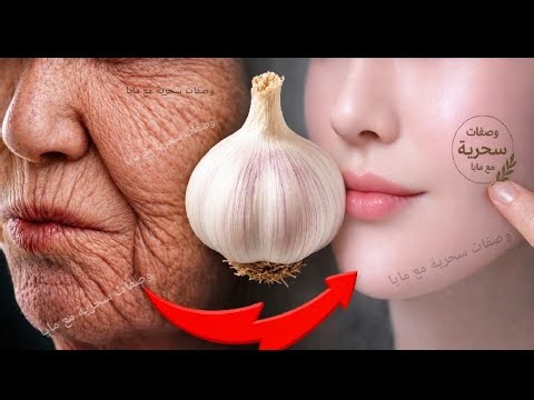 معجزة الثوم 🧄❗ ضعيها على التجاعيد وستختفى كأنك في العشرين من عمرك🌟قناع الثوم لبشرة متوهجة بيضاء
