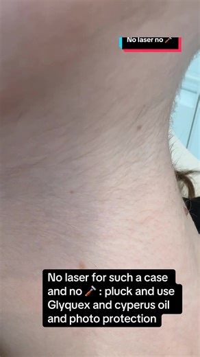 Effective Hair Removal Techniques in UAE